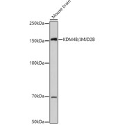 Western blot analysis of lysates from Mouse brain, using at 1/1000 dilution. Secondary antibody: HRP-conjugated Goat anti-Rabbit IgG (H+L) at 1/10000 dilution. Lysates/proteins: 25 µg per lane. Blocking buffer: 3% nonfat dry milk in TBST. Exposure time: 30s.