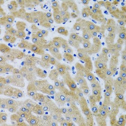Mannose-Binding Protein C (MBL2) Antibody