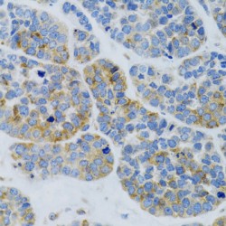 Mannose-Binding Protein C (MBL2) Antibody