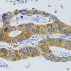 Mannose-Binding Protein C (MBL2) Antibody