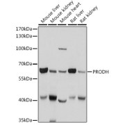 Western blot analysis of various lysates using PRODH Antibody at 1/1000 dilution. Secondary antibody: HRP-conjugated Goat anti-Rabbit IgG (H+L) at 1/10000 dilution. Lysates/proteins: 25 µg per lane. Blocking buffer: 3% nonfat dry milk in TBST. Exposure time: 1s.