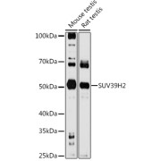 Western blot analysis of various lysates using SUV39H2 Antibody at 1/1000 dilution. Secondary antibody: HRP-conjugated Goat anti-Rabbit IgG (H+L) at 1/10000 dilution. Lysates/proteins: 25 µg per lane. Blocking buffer: 3% nonfat dry milk in TBST. Exposure time: 90s.