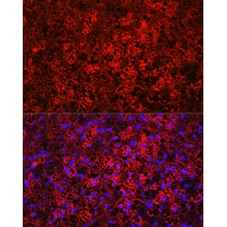 Mitochondrial Brown Fat Uncoupling Protein 1 (UCP1) Antibody