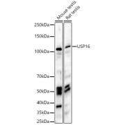 Western blot analysis of various lysates, using USP16 Antibody at 1/1000 dilution. Secondary antibody: HRP-conjugated Goat anti-Rabbit IgG (H+L) at 1/10000 dilution. Lysates/proteins: 25 µg per lane. Blocking buffer: 3% nonfat dry milk in TBST. Exposure time: 30s.