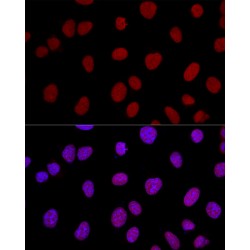 X-Ray Repair Cross Complementing 5 (XRCC5) Antibody