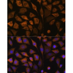 Staphylococcal Nuclease Domain-Containing Protein 1 (SND1) Antibody