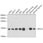 Western blot analysis of various lysates using RPS12 Antibody at 1/1000 dilution. Secondary antibody: HRP-conjugated Goat anti-Rabbit IgG (H+L) at 1/10000 dilution. Lysates/proteins: 25 µg per lane. Blocking buffer: 3% nonfat dry milk in TBST. Exposure time: 15s.