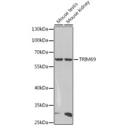 Western blot analysis of various lysates using TRIM69 Antibody at 1/1000 dilution. Secondary antibody: HRP-conjugated Goat anti-Rabbit IgG (H+L) at 1/10000 dilution. Lysates/proteins: 25 µg per lane. Blocking buffer: 3% nonfat dry milk in TBST. Exposure time: 90s.