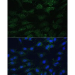 Eukaryotic Translation Initiation Factor 1A, X-Chromosomal (EIF1AX) Antibody