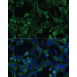 Eukaryotic Translation Initiation Factor 1A, X-Chromosomal (EIF1AX) Antibody