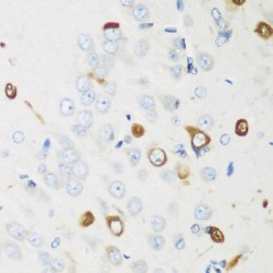 ELAV (Embryonic Lethal, Abnormal Vision, Drosophila)-Like 2 (Hu Antigen B) (ELAVL2) Antibody