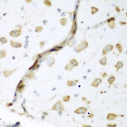 ELAV (Embryonic Lethal, Abnormal Vision, Drosophila)-Like 2 (Hu Antigen B) (ELAVL2) Antibody