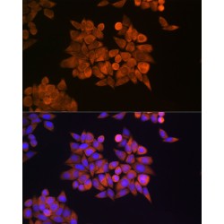 Eukaryotic Translation Termination Factor 1 (ETF1) Antibody