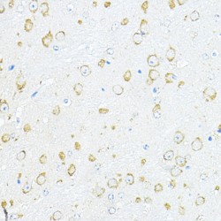 Ribosomal Protein L10A (RPL10A) Antibody