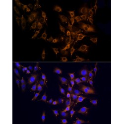 Ribosomal Protein L10A (RPL10A) Antibody