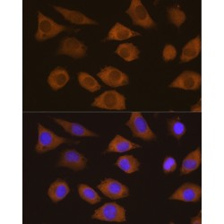 Cold Shock Domain Containing Protein E1 (CSDE1) Antibody