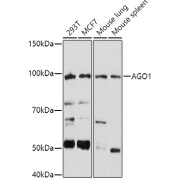 Western blot analysis of various lysates using at 1/1000 dilution. Secondary antibody: HRP-conjugated Goat anti-Rabbit IgG (H+L) at 1/10000 dilution. Lysates/proteins: 25 µg per lane. Blocking buffer: 3% nonfat dry milk in TBST. Exposure time: 180s.