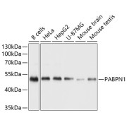 Western blot analysis of various lysates using PABPN1 Antibody at 1/1000 dilution. Secondary antibody: HRP-conjugated Goat anti-Rabbit IgG (H+L) at 1/10000 dilution. Lysates/proteins: 25 µg per lane. Blocking buffer: 3% nonfat dry milk in TBST. Exposure time: 1s.
