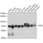 Western blot analysis of various lysates using PAIP1 Antibody at 1/1000 dilution. Secondary antibody: HRP-conjugated Goat anti-Rabbit IgG (H+L) at 1/10000 dilution. Lysates/proteins: 25 µg per lane. Blocking buffer: 3% nonfat dry milk in TBST. Exposure time: 30s.