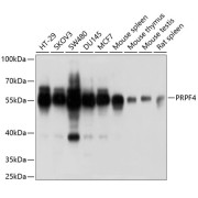 Western blot analysis of various lysates using PRPF4 Antibody at 1/1000 dilution. Secondary antibody: HRP-conjugated Goat anti-Rabbit IgG (H+L) at 1/10000 dilution. Lysates/proteins: 25 µg per lane. Blocking buffer: 3% nonfat dry milk in TBST. Exposure time: 1s.