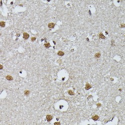 Pre-mRNA Processing Factor 4 (PRPF4) Antibody