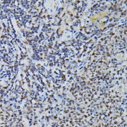 Pre-mRNA Processing Factor 4 (PRPF4) Antibody