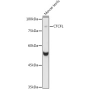 Western blot analysis of various lysates using CTCFL Antibody at 1/1000 dilution. Secondary antibody: HRP-conjugated Goat anti-Rabbit IgG (H+L) at 1/10000 dilution. Lysates/proteins: 25 µg per lane. Blocking buffer: 3% nonfat dry milk in TBST. Exposure time: 8s.