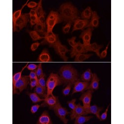 UDP-Glucuronosyltransferase 1-1 (UGT1A1) Antibody