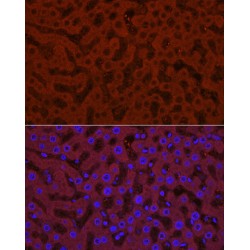 UDP-Glucuronosyltransferase 1-1 (UGT1A1) Antibody