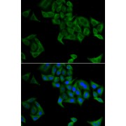 abx004730