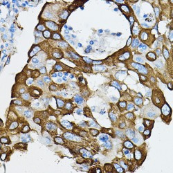 Interleukin 1 Receptor Associated Kinase 4 (IRAK4) Antibody