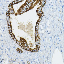 Interleukin 1 Receptor Associated Kinase 4 (IRAK4) Antibody