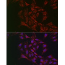 Patatin-Like Phospholipase Domain-Containing Protein 2 (PNPLA2) Antibody
