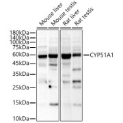 Western blot analysis of various lysates, using CYP51A1 Antibody at 1/800 dilution. Secondary antibody: HRP-conjugated Goat anti-Rabbit IgG (H+L) at 1/10000 dilution. Lysates/proteins: 25 µg per lane. Blocking buffer: 3% nonfat dry milk in TBST. Exposure time: 30s.