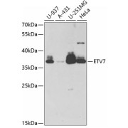 Western blot analysis of various lysates using ETV7 Antibody at 1/1000 dilution. Secondary antibody: HRP-conjugated Goat anti-Rabbit IgG (H+L) at 1/10000 dilution. Lysates/proteins: 25 µg per lane. Blocking buffer: 3% nonfat dry milk in TBST. Exposure time: 60s.