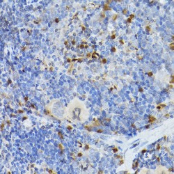 Leukocyte Elastase Inhibitor (SERPINB1) Antibody