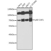 Western blot analysis of various lysates using p60 CAF1 Antibody at 1/1000 dilution. Secondary antibody: HRP-conjugated Goat anti-Rabbit IgG (H+L) at 1/10000 dilution. Lysates/proteins: 25 µg per lane. Blocking buffer: 3% nonfat dry milk in TBST. Exposure time: 30s.