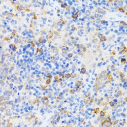 Chromatin Assembly Factor 1, Subunit B (CHAF1B) Antibody