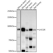Western blot analysis of various lysates using LHCGR Antibody at 1/500 dilution. Secondary antibody: HRP-conjugated Goat anti-Rabbit IgG (H+L) at 1/10000 dilution. Lysates/proteins: 25 µg per lane. Blocking buffer: 3% nonfat dry milk in TBST. Exposure time: 90s.