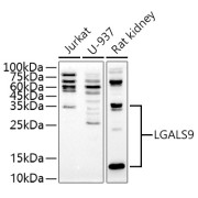 Western blot analysis of various lysates using LGALS9 Antibody at 1/1000 dilution. Secondary antibody: HRP-conjugated Goat anti-Rabbit IgG (H+L) at 1/10000 dilution. Lysates/proteins: 25 µg per lane. Blocking buffer: 3% nonfat dry milk in TBST. Exposure time: 180s.