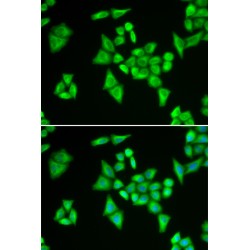 Adenylosuccinate Lyase (ADSL) Antibody