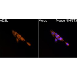 Adenylosuccinate Lyase (ADSL) Antibody