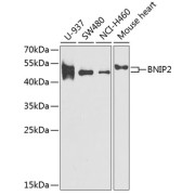 Western blot analysis of various lysates using BNIP2 Antibody at 1/1000 dilution. Secondary antibody: HRP-conjugated Goat anti-Rabbit IgG (H+L) at 1/10000 dilution. Lysates/proteins: 25 µg per lane. Blocking buffer: 3% nonfat dry milk in TBST. Exposure time: 90s.