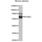 Western blot analysis of lysates from mouse plasma, using KCNA2 Antibody at 1/1000 dilution. Secondary antibody: HRP-conjugated Goat anti-Rabbit IgG (H+L) at 1/10000 dilution. Lysates/proteins: 25 µg per lane. Blocking buffer: 3% nonfat dry milk in TBST. Exposure time: 90s.