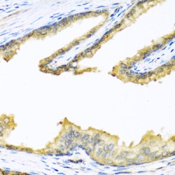 Proenkephalin A (PENK) Antibody