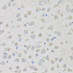 Proenkephalin A (PENK) Antibody