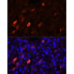 Proenkephalin A (PENK) Antibody