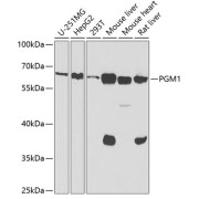Western blot analysis of various lysates using PGM1 Antibody at 1/1000 dilution. Secondary antibody: HRP-conjugated Goat anti-Rabbit IgG (H+L) at 1/10000 dilution. Lysates/proteins: 25 µg per lane. Blocking buffer: 3% nonfat dry milk in TBST. Exposure time: 60s.