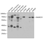Western blot analysis of various lysates using SMARCD1 Antibody at 1/1000 dilution. Secondary antibody: HRP-conjugated Goat anti-Rabbit IgG (H+L) at 1/10000 dilution. Lysates/proteins: 25 µg per lane. Blocking buffer: 3% nonfat dry milk in TBST. Exposure time: 30s.