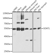 Western blot analysis of various lysates using SOAT1 Antibody at 1/1000 dilution. Secondary antibody: HRP-conjugated Goat anti-Rabbit IgG (H+L) at 1/10000 dilution. Lysates/proteins: 25 µg per lane. Blocking buffer: 3% nonfat dry milk in TBST. Exposure time: 10s.